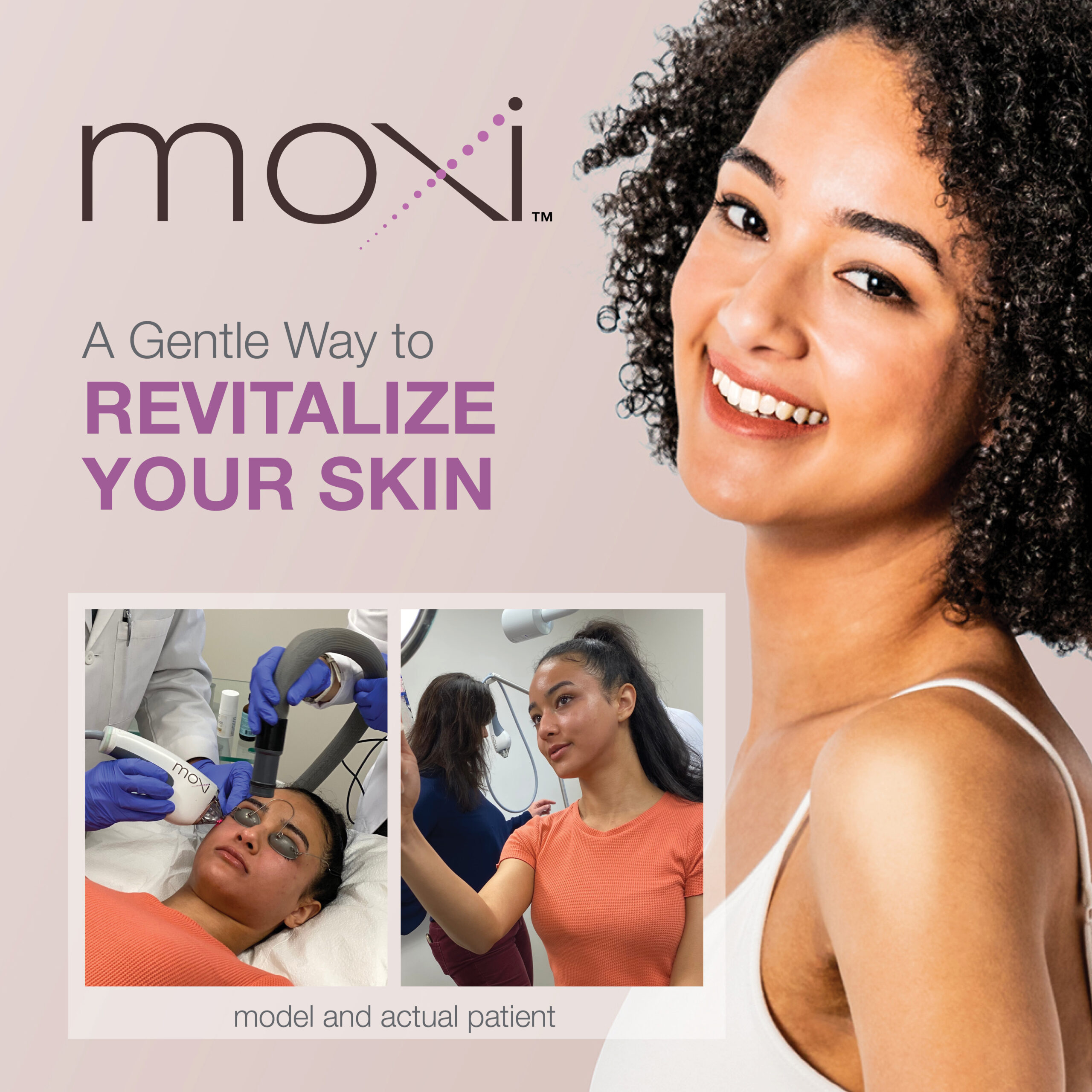 Moxi Laser in Tacoma Washington at Northwest Medical Arts