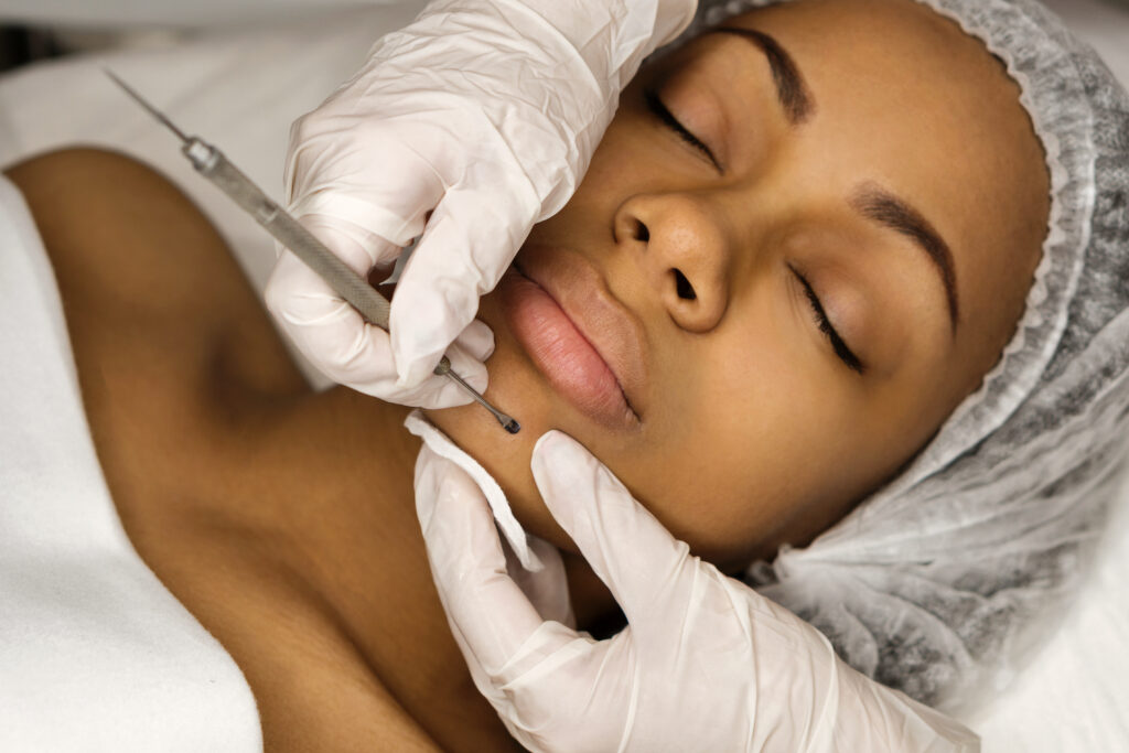 Aesthetician Services at Northwest Medical Arts in Tacoma, WA. Procedure mechanical face cleaning in beauty salon. Afro american young model getting cosmetic face skin care and treatments in cosmetologist. Spa, cosmetology and wellness relaxation concept.